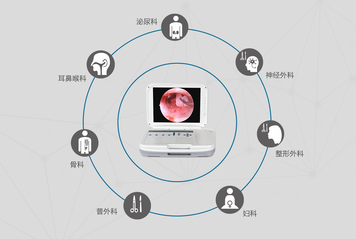 內(nèi)窺鏡攝像機的應(yīng)用領(lǐng)域有哪些？