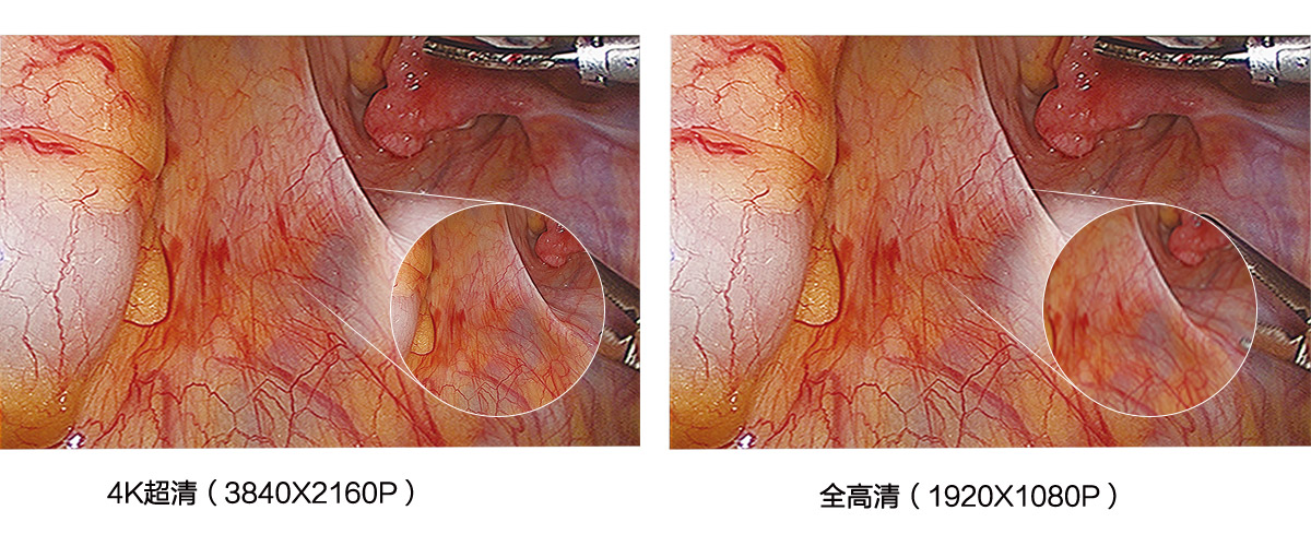 益柯達(dá)4K超高清內(nèi)窺鏡攝像系統(tǒng)