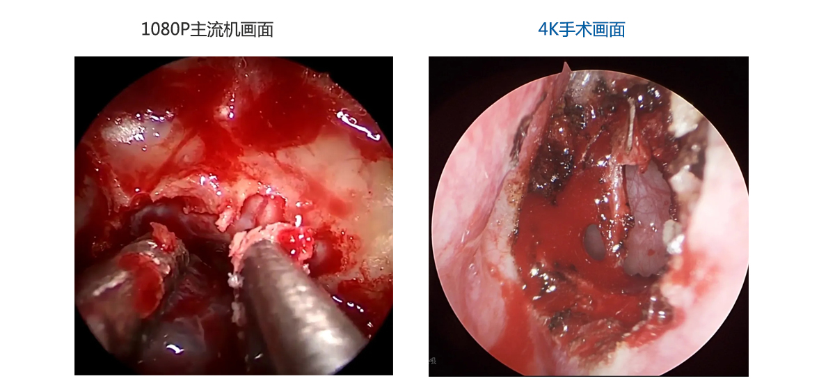 益柯達(dá)與您共同開(kāi)啟4K超高清時(shí)代