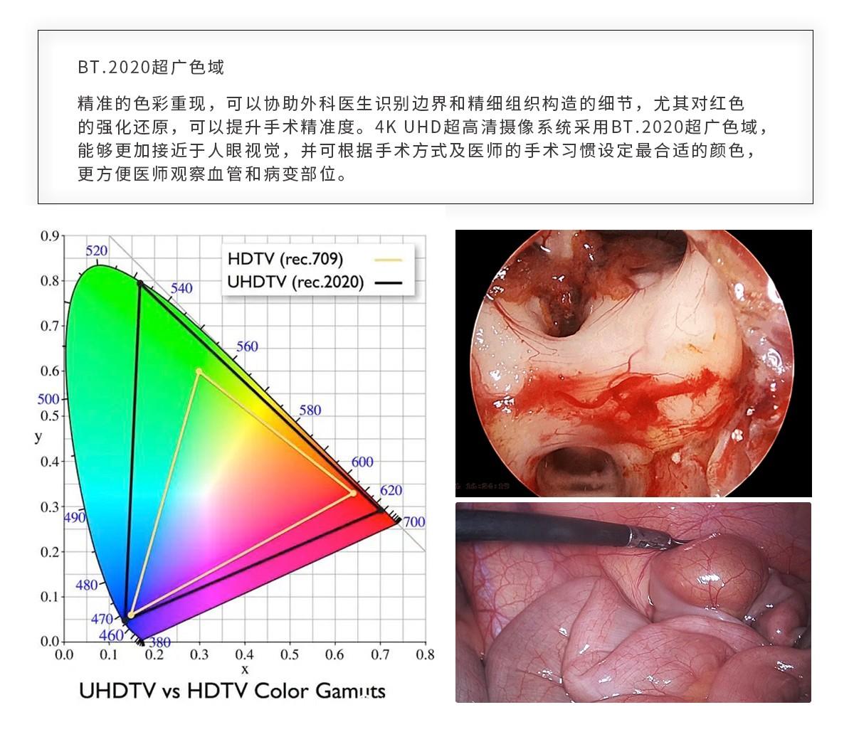 【4K醫(yī)用內(nèi)窺鏡攝像系統(tǒng)】您的第一臺“4K”找到了嗎？